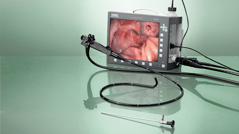 内視鏡検査について